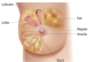 Breast cancer - Symptoms and causes -